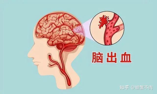 高血压的危害你注意了吗？